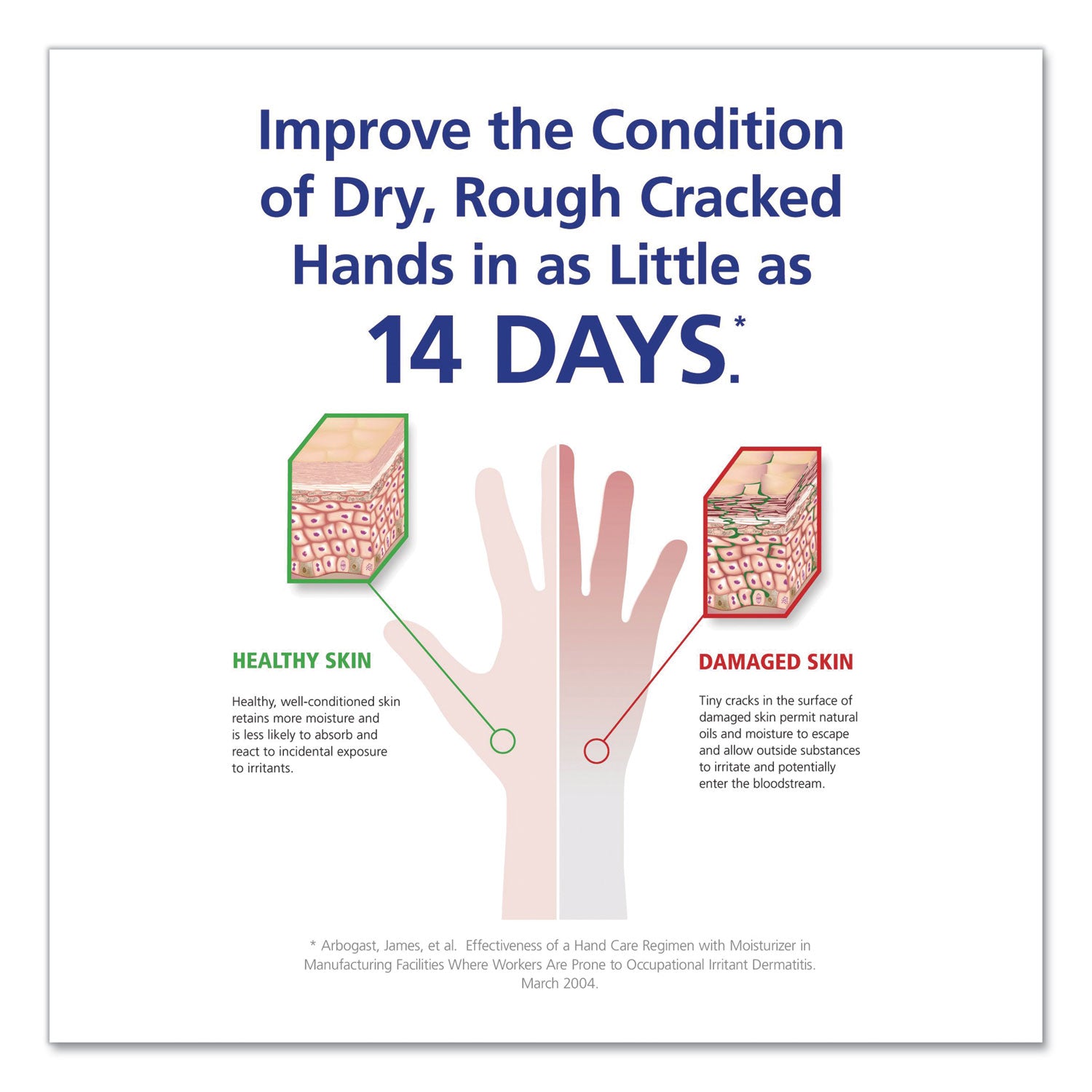 GOJO® HAND MEDIC Professional Skin Conditioner for Industrial Environments, Refill for GOJO ADX-7 Dispenser, 685 mL, 4/Carton