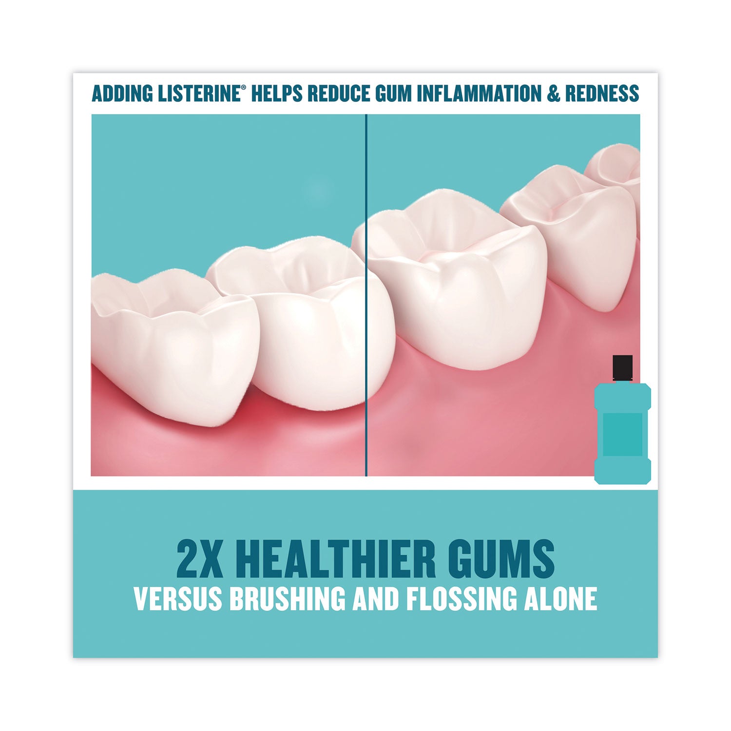 Johnson & Johnson® Listerine Cool Mint Mouthwash, 1 L Bottle